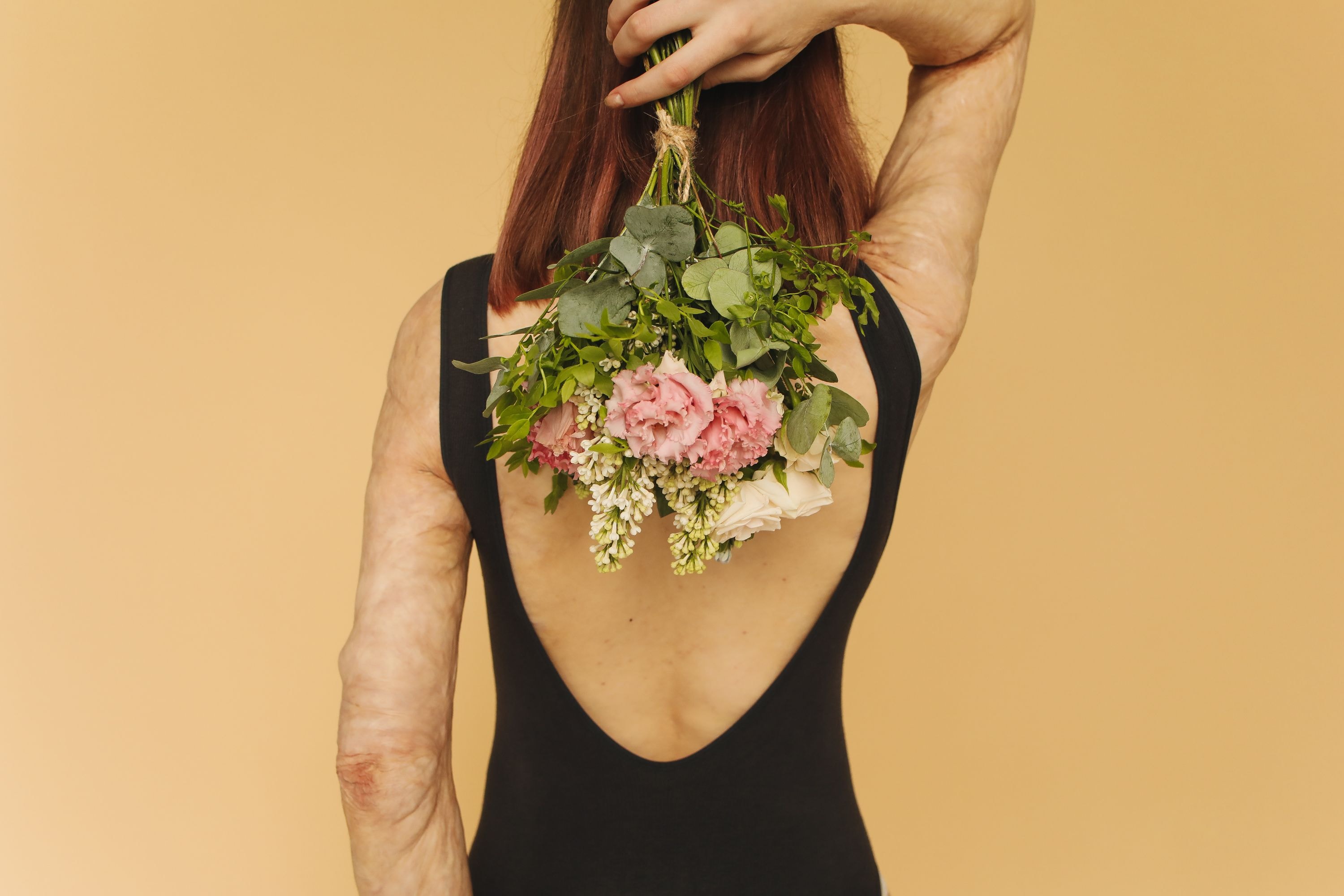 Wear Ur Scars community — diverse women supporting each other